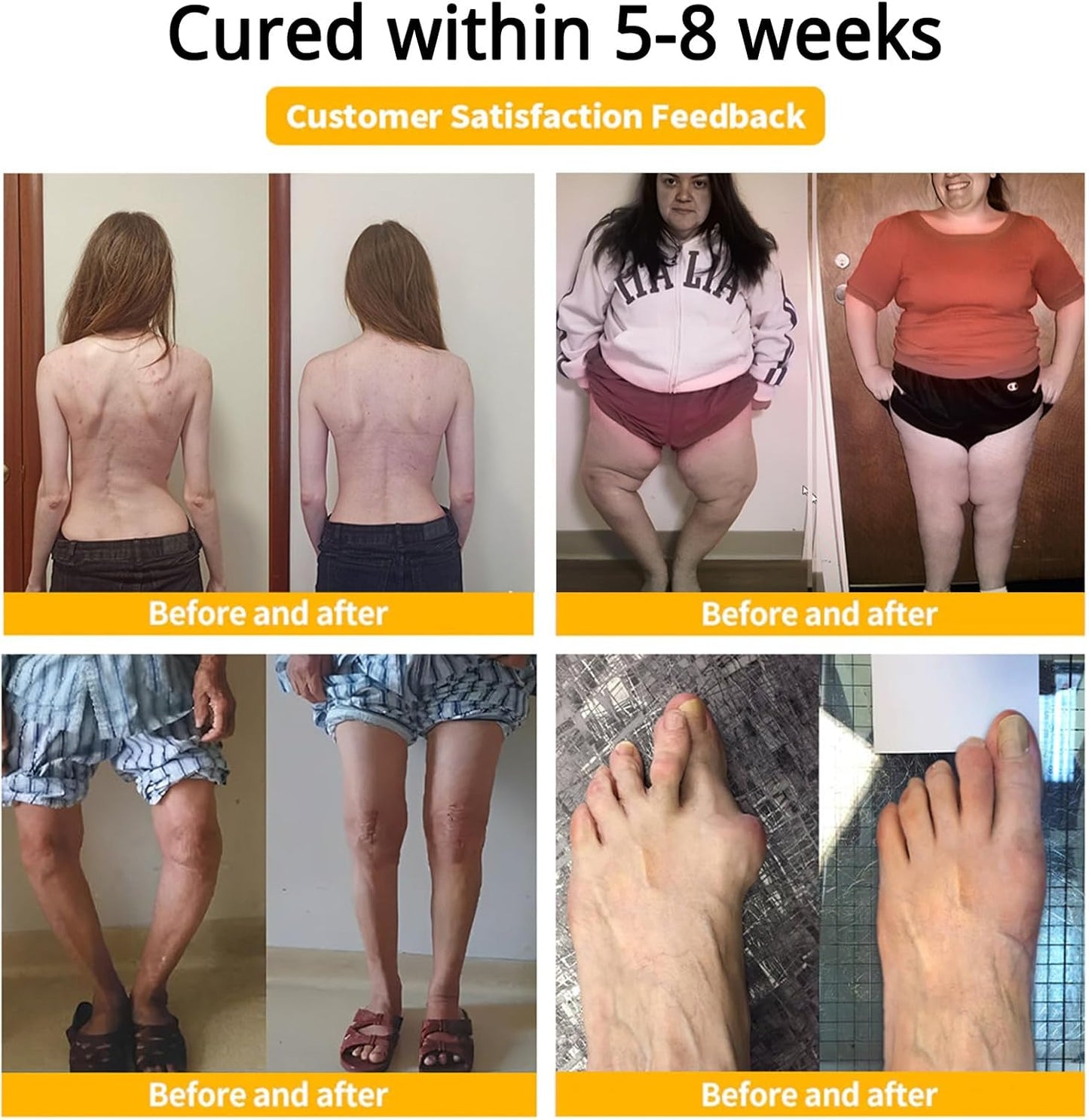 '+ BeeFlex™ - Bee-Venom Pain-Relief Bone Healing Cream 🐝✨(Buy 1 Get 1 Free🔥🔥)